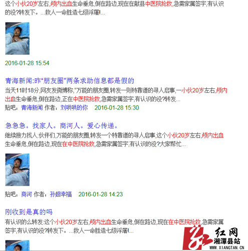 颅内出血2